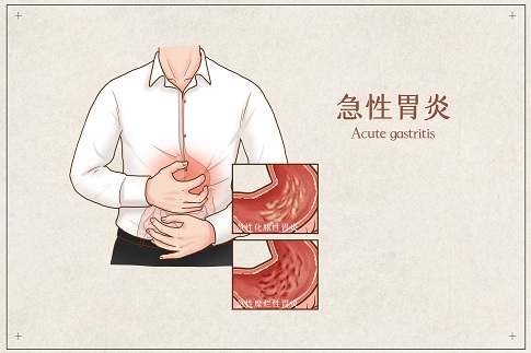 1656689842525012.jpg 攝圖網_401789692_banner_急性胃炎醫療插畫(企業商用).jpg