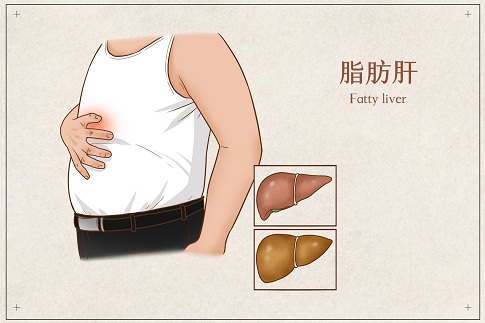1659025844405181.jpg 攝圖網(wǎng)_401804062_banner_脂肪肝醫(yī)療插畫(企業(yè)商用).jpg