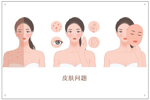 1660061700258770.jpg 攝圖網(wǎng)_401803308_女性各種皮膚問題(企業(yè)商用).jpg