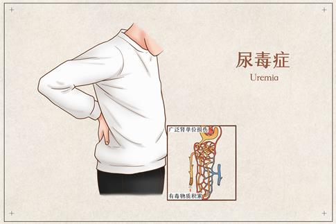 1661810144665701.jpg 攝圖網_401794004_banner_尿毒癥醫療插畫(非企業商用) (1).jpg