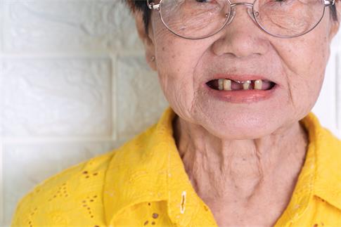 1682394210231459.jpg 攝圖網_308021423_70歲以上的亞洲老年婦女笑著微牙齒有幾顆斷裂的牙齒這里難以咀嚼老人的食物這里需要假牙來替代缺失的齒和幫助咀嚼食物這需要用假牙替換(企業商用).jpg