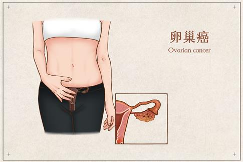 1682494196777748.jpg 攝圖網(wǎng)_401800159_banner_卵巢癌醫(yī)療插畫(企業(yè)商用).jpg