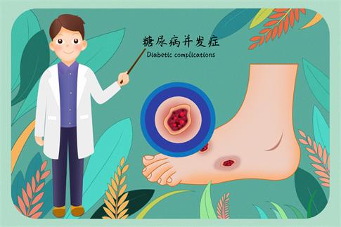 1688437667471521.jpg 攝圖網(wǎng)_401865897_banner_糖尿病并發(fā)癥糖尿病足醫(yī)療插畫(huà)(企業(yè)商用).jpg