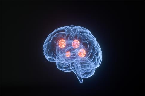 1693526613362250.jpg 攝圖網_401808392_banner_3D疾病腦癌場景(企業商用).jpg