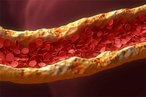 1695864412359321.jpg 攝圖網(wǎng)_600221639_banner_冠狀動(dòng)脈硬化(企業(yè)商用).jpg