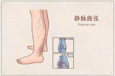 zDW_401799108_o}t宋(I).jpg