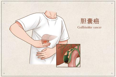 1728604499252477.jpg 攝圖網_401794948_膽囊癌醫療插畫(非企業商用).jpg