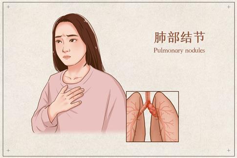 1738973377843258.jpg 攝圖網(wǎng)_401863170_banner_肺部結(jié)節(jié)醫(yī)療插畫(企業(yè)商用).jpg
